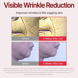 //img.ltwebstatic.com/v4/j/spmp/2026/03/06/54/1772769325107b5616b419cd884697c6ee7b57cc26_square_thumbnail_900x.webp